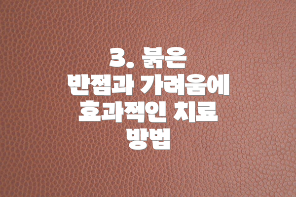 3. 붉은 반점과 가려움에 효과적인 치료 방법